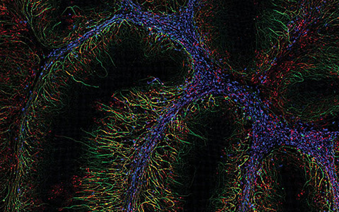 奧林巴斯顯微鏡SEO優(yōu)化